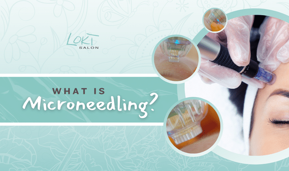 What is microneedling?.